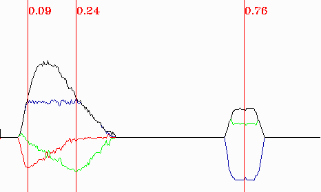 Abbildung 6: Auswertung des Chromatogramms